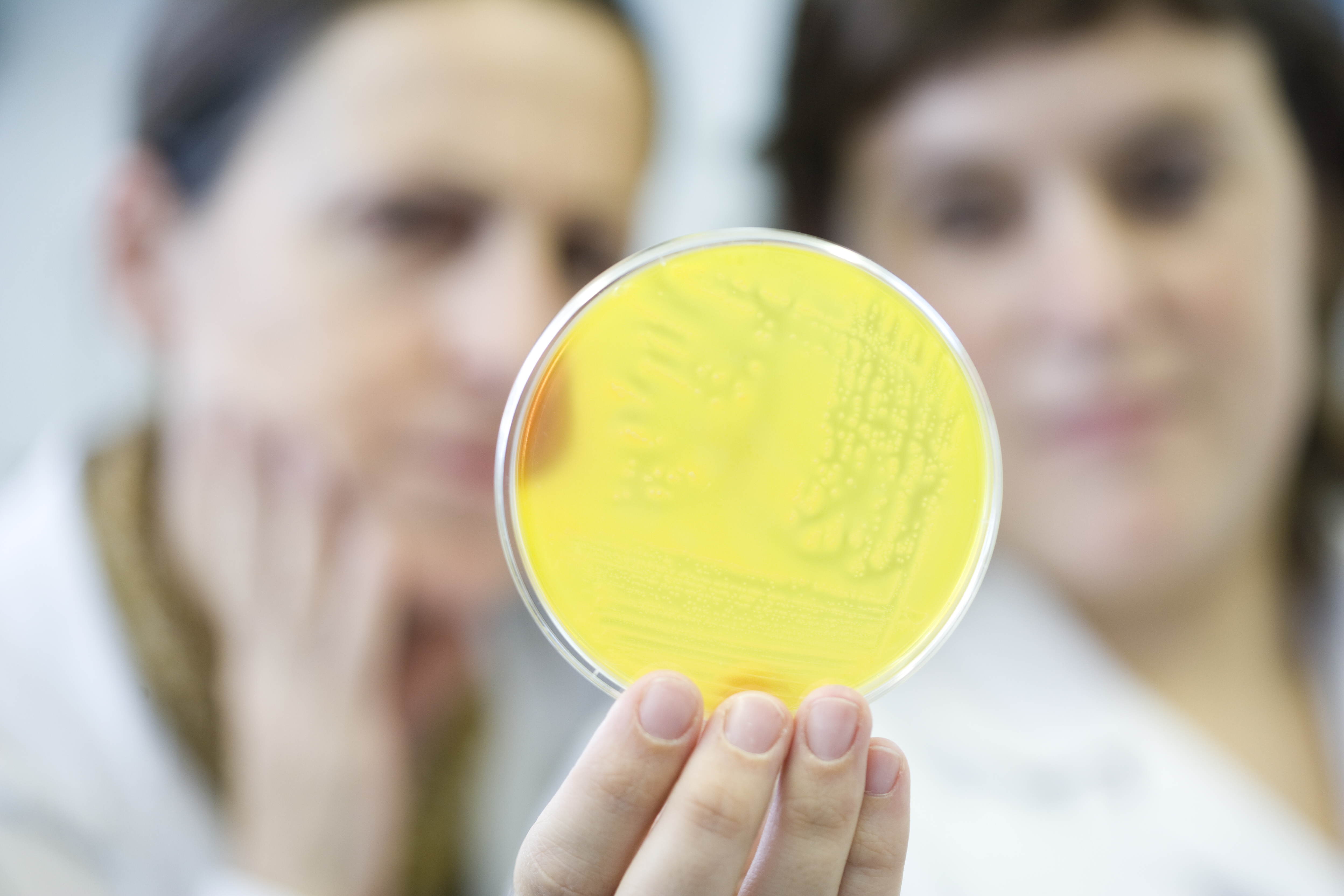 Servicio de análisis de alimentación